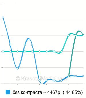 Средняя стоимость МРТ головного мозга в Твери